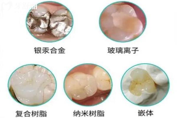 2025壹顆芽口腔醫(yī)院收費明細表已出 山東正規(guī)牙科價格透明種牙矯正不貴