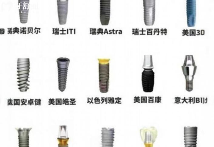保定合眾口腔種植牙怎么樣