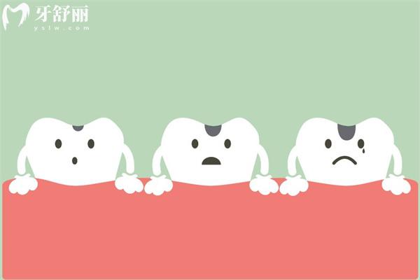 牙齒過度磨損照片
