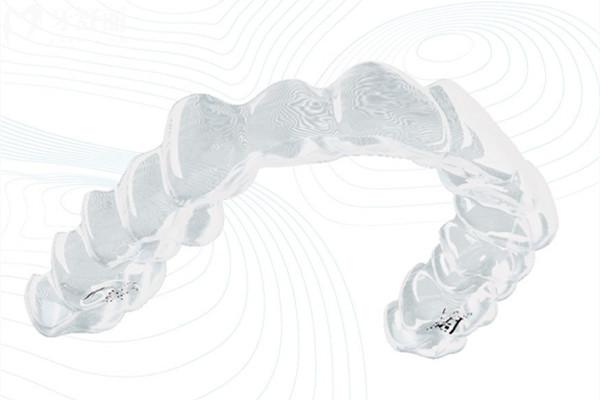 國產(chǎn)隱形矯正vs進口隱形矯正