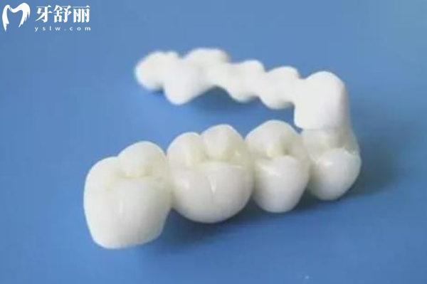 愛迪特VS愛爾創(chuàng)全瓷牙哪個(gè)質(zhì)量好