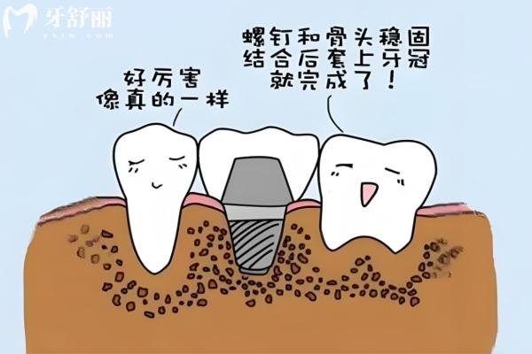 上海民營(yíng)口腔醫(yī)院排名前十 疑難種植/數(shù)字化種植/即刻種植這幾家技術(shù)很可靠