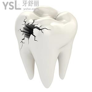 補(bǔ)牙后牙齒酸痛正常嗎
