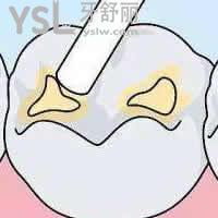 北京京仁博愛口腔3M納米樹脂補牙優(yōu)惠活動