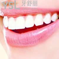 天津愛齒口腔皓齒美白牙齒雙11優(yōu)惠價格