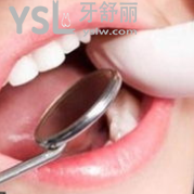 牙科哪些項(xiàng)目可以進(jìn)行醫(yī)保報(bào)銷?哪些項(xiàng)目不可以?