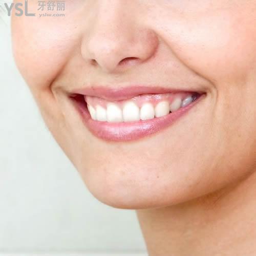 超低價(jià)！成都圣貝口腔炫彩專業(yè)美白標(biāo)準(zhǔn)型套餐優(yōu)惠價(jià)
