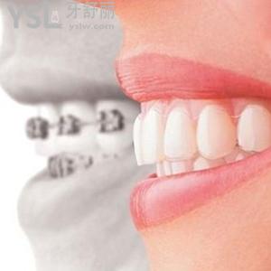 鄭州唯美口腔牙齒矯正多少錢