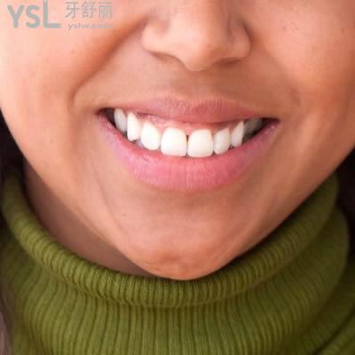 北京瑞泰口腔醫(yī)院金屬托槽矯正收費標(biāo)準(zhǔn)