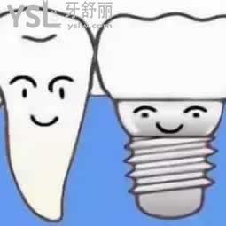 深圳格倫菲爾口腔美國皓圣種植牙收費怎么樣？