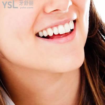 深圳雷蕾口腔陶瓷自鎖托槽矯正價格貴嗎？