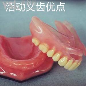 山東日照凱思口腔隱形活動義齒價格