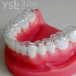 深圳拜爾齒科隱形牙齒矯正收費(fèi)怎么樣