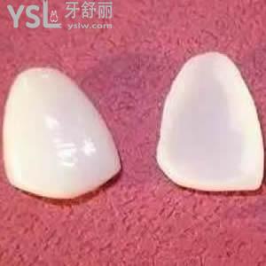 深圳拜爾口腔牙齒美白貼面價(jià)格