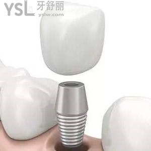 深圳拜爾口腔韓國登騰種植牙價格表