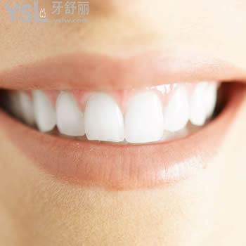 揭曉佛山春芽口腔怎么樣?公開(kāi)佛山春芽口腔美加貼面價(jià)格表