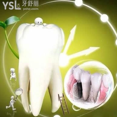 韓國奧齒泰OSSTEM種植牙質(zhì)量怎么樣？廣安金典口腔奧齒泰種植體價格為什么比較便宜？