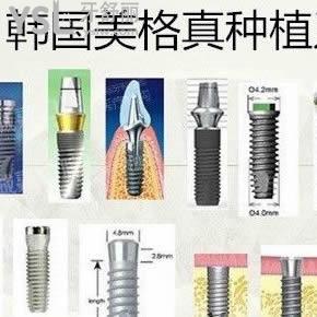 西安中諾口腔醫(yī)院韓國美格真種植牙價(jià)格表
