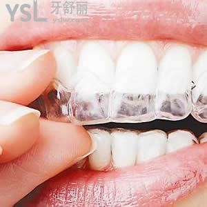 鄭州唯美口腔正雅smartee隱形牙齒矯正多少錢