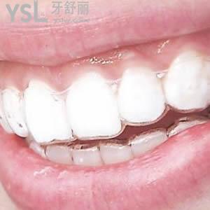 廣州圣貝牙科時(shí)代天使隱形牙齒矯正價(jià)格貴不貴