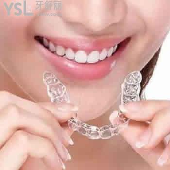 有一份西安畫美牙科時(shí)代天使正畸價(jià)格表及顧客評價(jià)參考