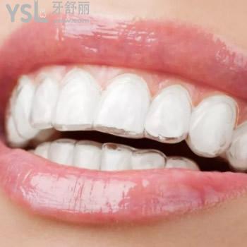 公布深圳雅適美口腔時(shí)代天使comfos價(jià)格表及深圳牙科醫(yī)院前十位排名