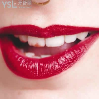 整牙必看深圳雅適美口腔美加超薄瓷貼面價(jià)格表