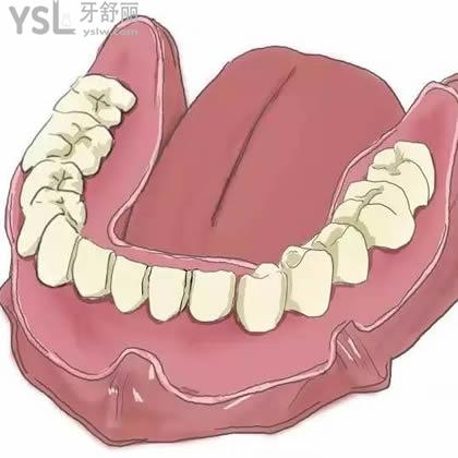 南京雅康口腔韓國進(jìn)口種植體價目表