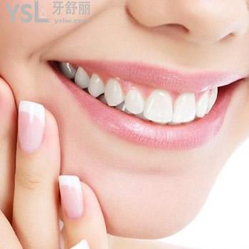 深圳質(zhì)美口腔陶瓷自鎖矯正收費(fèi)貴不貴？