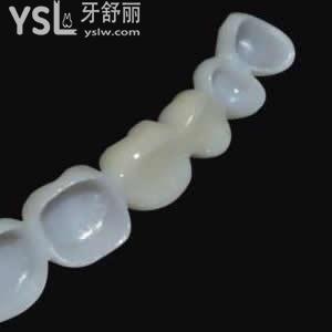 寧波口腔愛爾創(chuàng)全瓷牙收費貴不