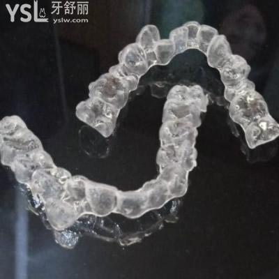 深圳質(zhì)美口腔隱適美隱形矯正矯正齙牙多少錢？