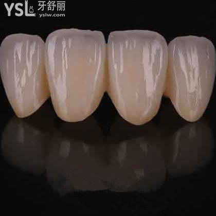 深圳質(zhì)美口腔澤康全鋯冠收費標(biāo)準(zhǔn)