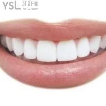 深圳質(zhì)美口腔韓國奧齒泰種植體包干價是多少錢？