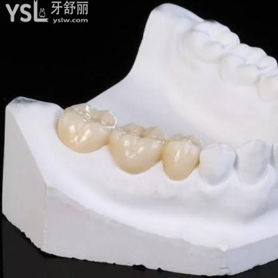 深圳質美口腔威蘭德全鋯冠收費標準
