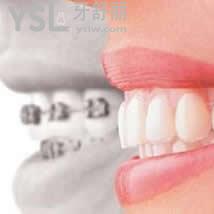 杭州美奧口腔牙齒矯正收費(fèi)多少錢？
