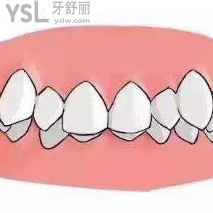 天津中諾口腔牙齒矯正價(jià)格一般是多少錢？