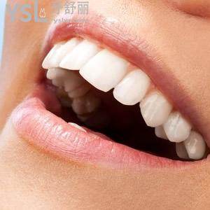 西安美奧口腔時(shí)代天使隱形矯正價(jià)格表