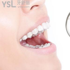 深圳樂莎莎口腔價(jià)格表隱形矯正多少錢？