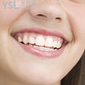 深圳市拜爾口腔門診部收費(fèi)標(biāo)準(zhǔn)時(shí)代天使隱形矯正多少錢？