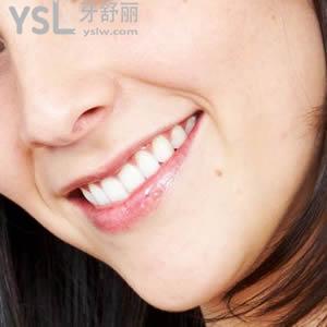 來看一下成都圣貝牙科正雅隱形矯正價格表