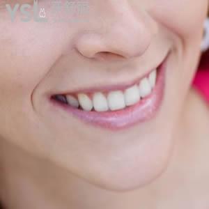 杭州維多利亞口腔醫(yī)院冷光美白價(jià)格超低優(yōu)惠來(lái)嘍