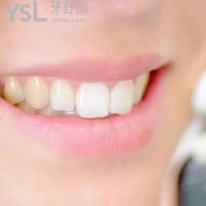 北京圣貝口腔全瓷牙收費(fèi)標(biāo)準(zhǔn)如何。