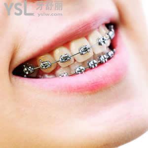 北京圣貝口腔價目表樹脂補(bǔ)牙超低優(yōu)惠價格來襲！