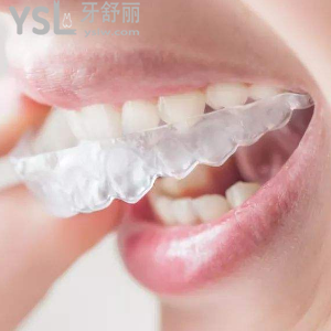 保定合眾口腔收費(fèi)標(biāo)準(zhǔn)之隱形矯正多少錢？價格貴嗎？