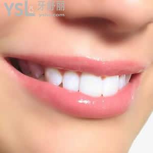 沈陽歡樂仁愛口腔醫(yī)院收費(fèi)標(biāo)準(zhǔn)之隱形矯正暑期價(jià)格多少錢？