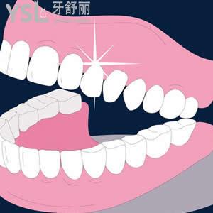 世紀(jì)河山口腔收費(fèi)標(biāo)準(zhǔn)致陶瓷托槽牙套價(jià)格貴嗎？