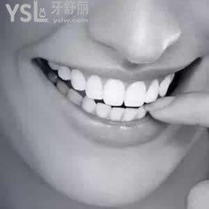 南通牙博士口腔門診部價格表之鑄瓷嵌體貴嗎？