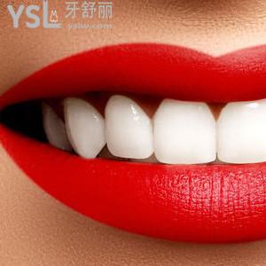 好消息：昆明美奧口腔醫(yī)院正雅全隱形矯正（兩人拼團(tuán)）驚爆價(jià)！