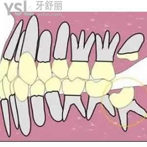 牙科醫(yī)院和醫(yī)院口腔科區(qū)別？