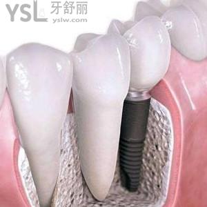 廣東金屬托槽矯正價(jià)格多少？珠海九龍口腔價(jià)格優(yōu)惠大揭秘